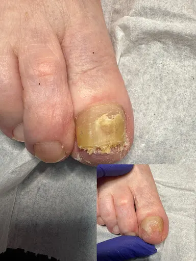 Svitlana Popova Podolog PodoLady